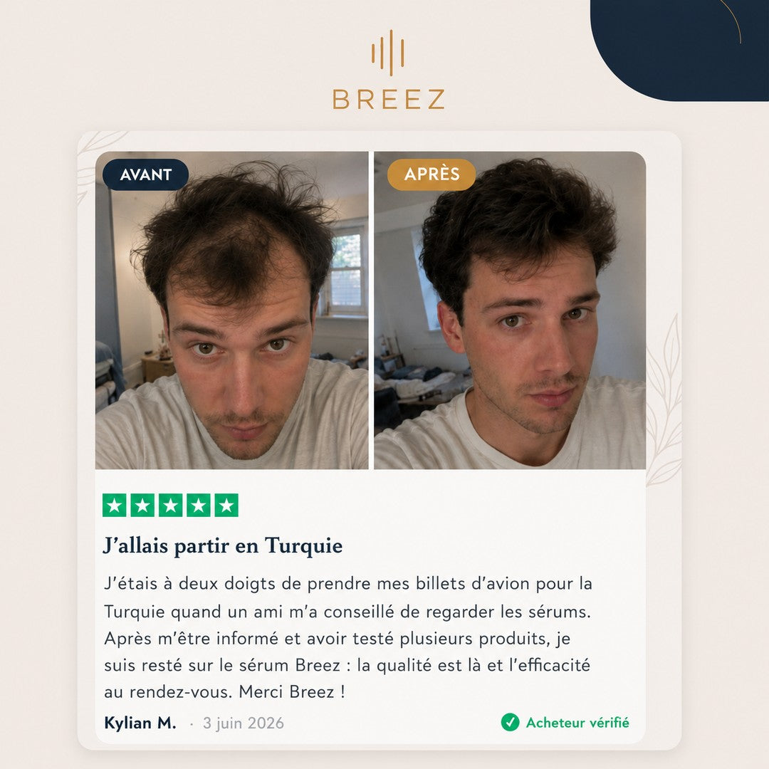 Avis vérifié Kylian M. — résultat avant/après avec le sérum BREEZ, note 5 étoiles