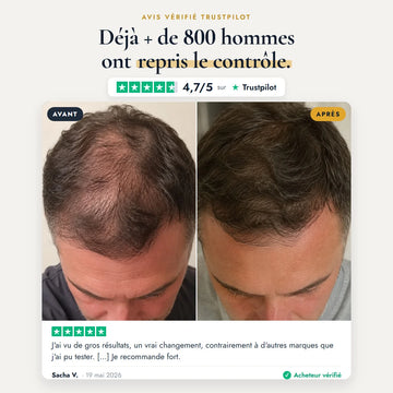 Déjà + de 800 hommes ont repris le contrôle — 4,7/5 sur Trustpilot, avant après de Sacha V. sur le sommet du crâne