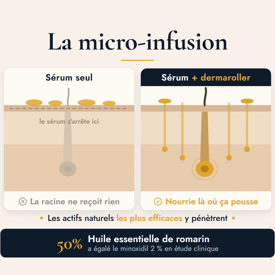 La micro-infusion BREEZ : un sérum seul reste en surface et n'atteint pas la racine, le sérum avec le dermaroller descend jusqu'au follicule, 50 % d'huile essentielle de romarin