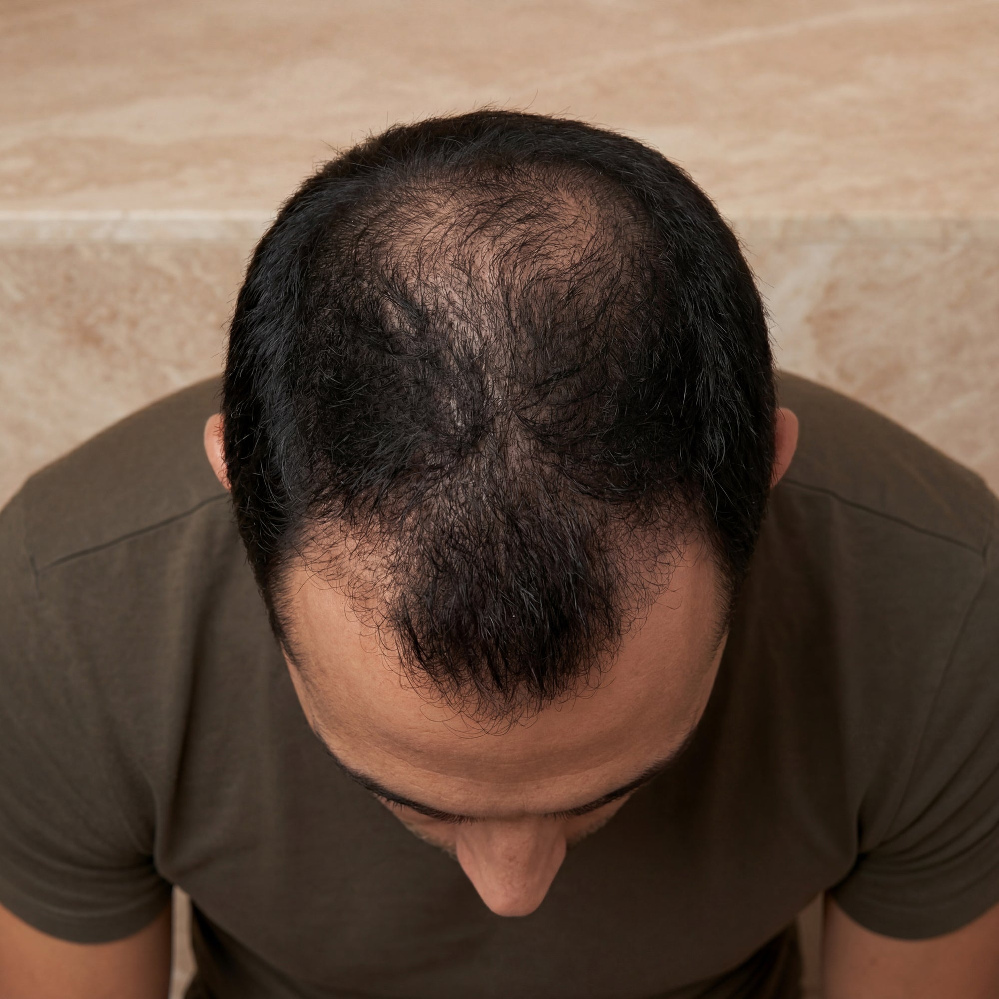 Transformation capillaire homme — Programme 90 jours BREEZ