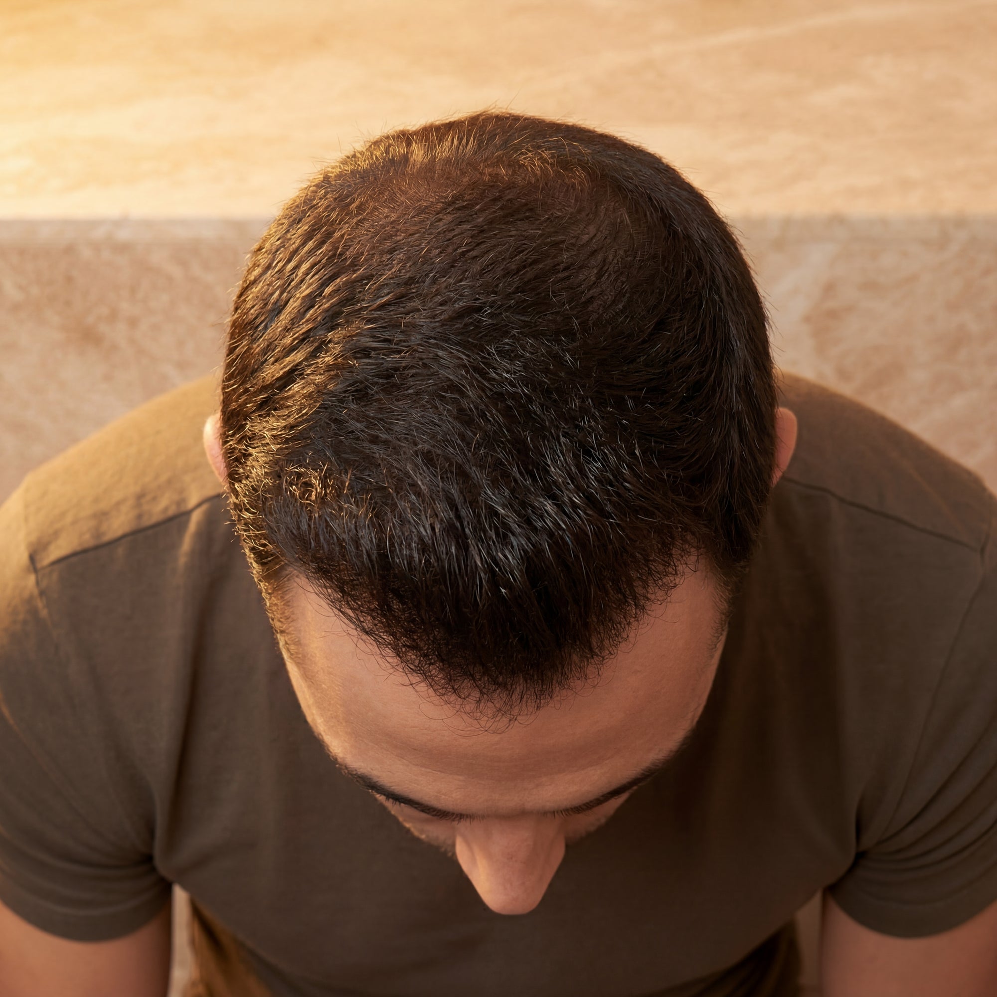 Densité capillaire renforcée homme — Programme 90 jours BREEZ
