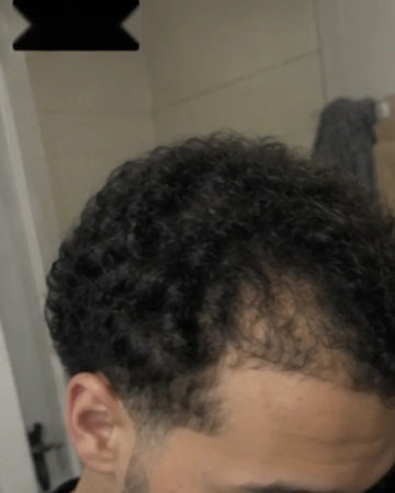 Avant — golfes naissants sur cheveux bouclés