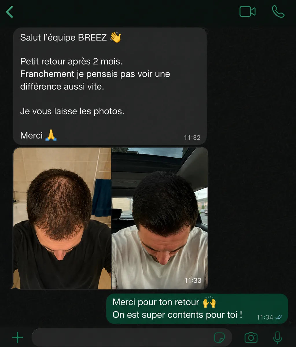 Capture d'une conversation : « Petit retour après 2 mois… je pensais pas voir une différence aussi vite », avec deux photos avant/après.