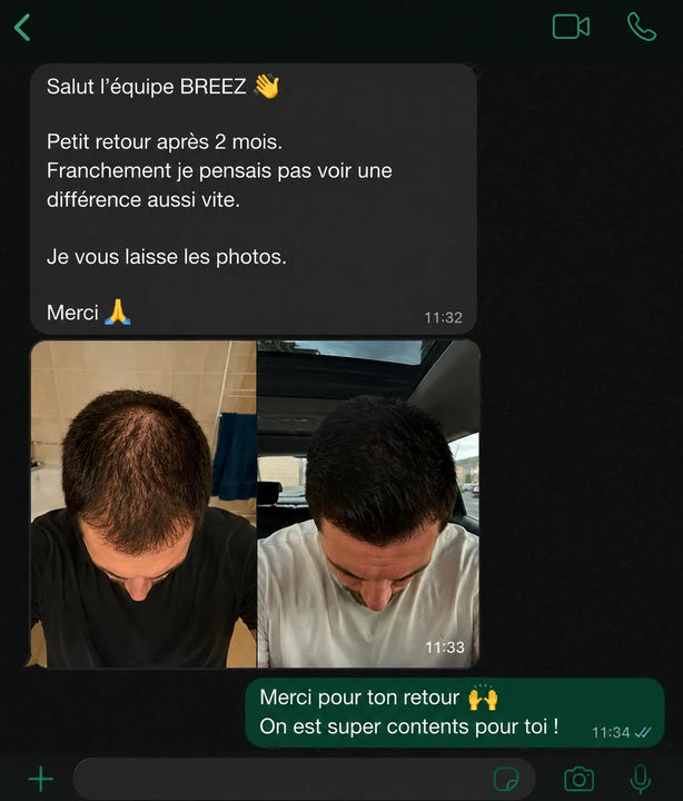 Retour client apres 2 mois d'utilisation du serum BREEZ.