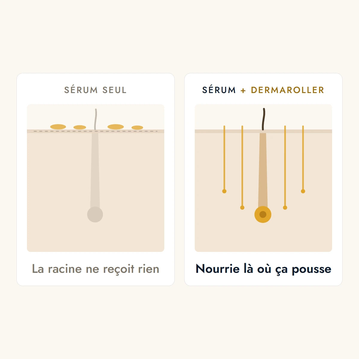 Deux coupes de cuir chevelu : sans dermaroller le sérum reste en surface, avec dermaroller il descend jusqu'à la racine