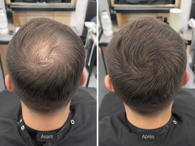 Avant et après une application de poudre densifiante, vue de dos chez le coiffeur