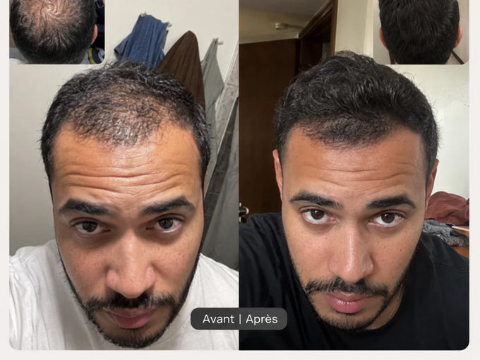 Avant et après une application de poudre densifiante, vue de face